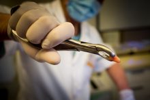 Cand ai nevoie neaparat de extractii dentare?